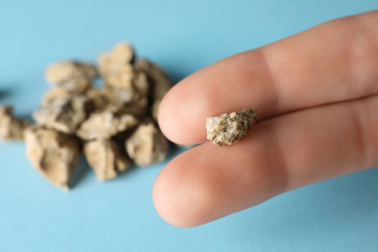 Kidney Stone Prevention